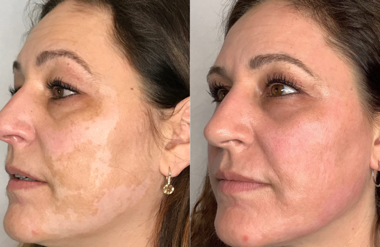 24920_Rebekah-W-Pearl-768x499