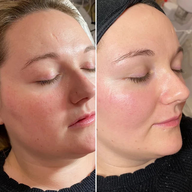 35d171_afbeb37a73e34980ab108002204aab66~mv2